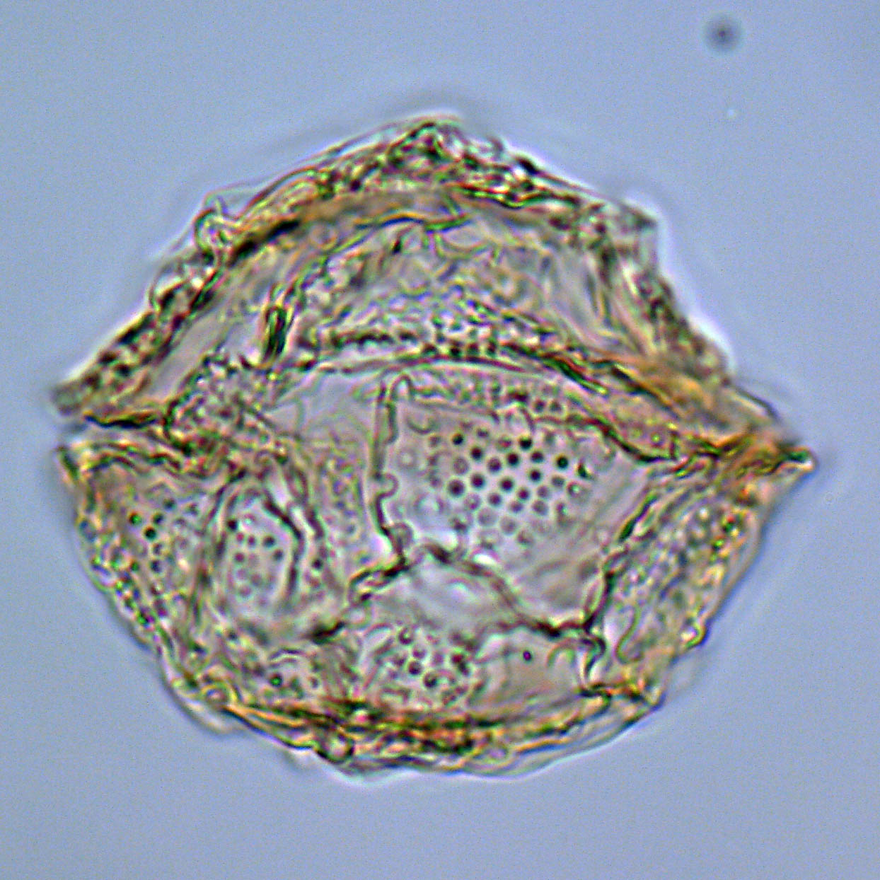 Heteraulacacysta porosa, 1410C-8H-4, 65-67, W21-1, foto-d.jpg